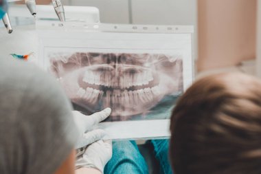 Bir ortodontist doktor çocuğa diş röntgenini gösterdi. 2020