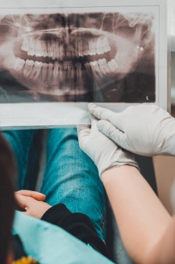 Bir ortodontist doktor çocuğa dişlerinin röntgenini gösteriyor. Opg, 3 boyutlu tanı.