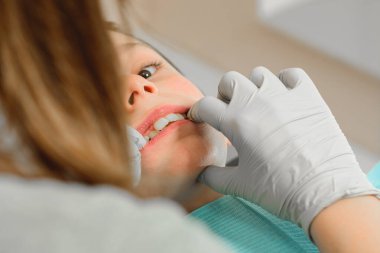 Ortodontist çocuğun dişlerinden bir ısırık alıyor mu diye kontrol ediyor. 2020