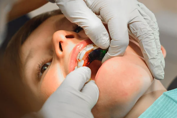 Menino Com Boca Aberta Fica Cadeira Dentista Enquanto Ortodontista Segura — Fotografia de Stock