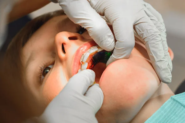 Menino Com Boca Aberta Fica Cadeira Dentista Enquanto Ortodontista Segura — Fotografia de Stock