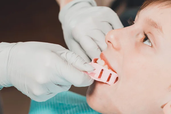 Der Junge Kieferorthopäde Macht Eine Anpassung Für Die Platte 2020 — Stockfoto