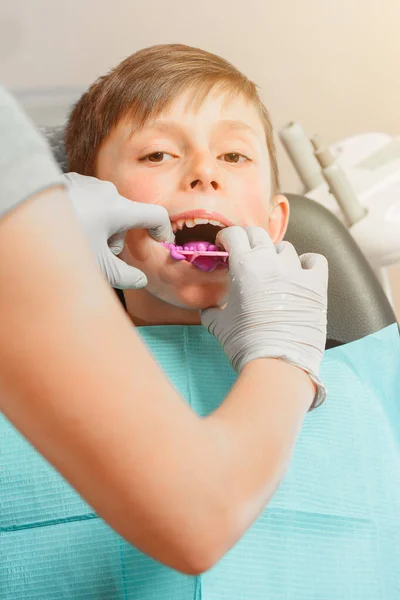 Junge Zahnarztstuhl Mit Abformtablett Mund 2020 — Stockfoto
