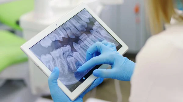 便携式装置上牙齿的X光检查 图库图片