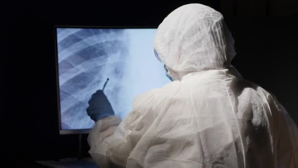 El hombre trabaja con una foto de rayos X de neumonía pulmonar — Vídeos de Stock