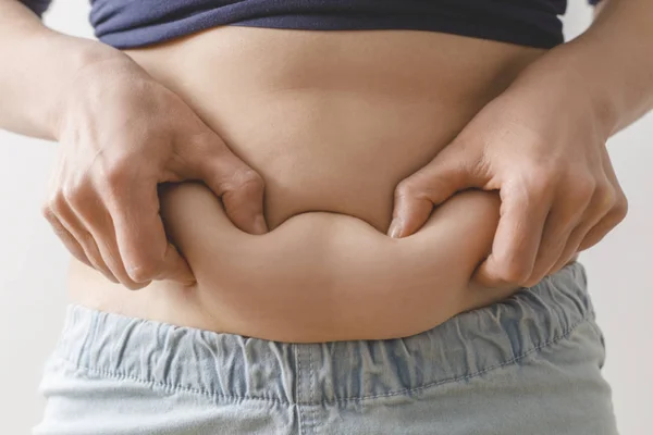 Mulher Segura Mãos Gordas Seu Estômago Barriga Excesso Peso — Fotografia de Stock