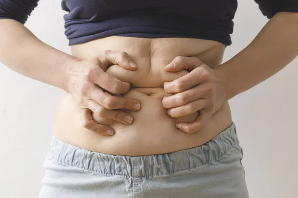 Mulher Segura Mãos Gordas Seu Estômago Barriga Excesso Peso — Fotografia de Stock