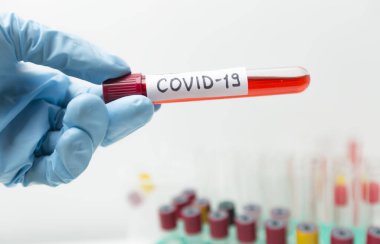 Mikrobiyolog Coronavirus Covid-19 için kan testi yapan bir tüp tutuyor..