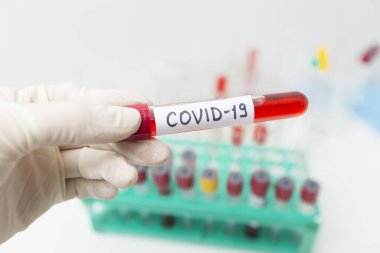 Mikrobiyolog Coronavirus Covid-19 için kan testi yapan bir tüp tutuyor..