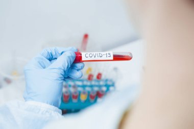 Mikrobiyolog Coronavirus Covid-19 için kan testi yapan bir tüp tutuyor..