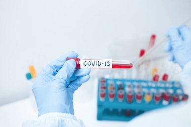 Mikrobiyolog Coronavirus Covid-19 için kan testi yapan bir tüp tutuyor..
