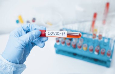 Mikrobiyolog Coronavirus Covid-19 için kan testi yapan bir tüp tutuyor..