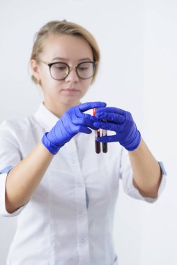 Doktor ellerinde kan örnekleri olan iki tüpü inceliyor. Doktor laboratuvarda kan tüpü tutuyor.