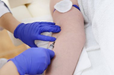 Eldeki damardan alınan kan testi. Kapat.