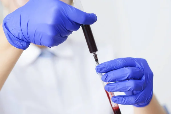 Doctor Latex Gloves Holding Syringe Blood Sample Test Tube — Stock Photo, Image