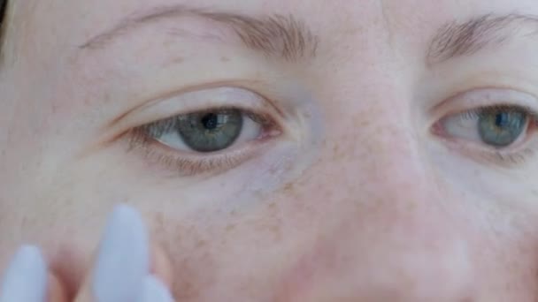 Женщина Накладывает Пластыри Глазами Освежающей Маски Женщина Коллагеновыми Прокладками Глазами — стоковое видео