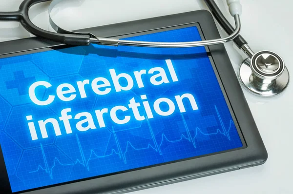 Tablet with the diagnosis Cerebral infarction on the display — Stock Photo, Image