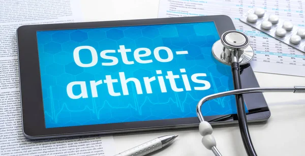 Szó Osteoarthritis Kijelzőn Egy Tabletta — Stock Fotó