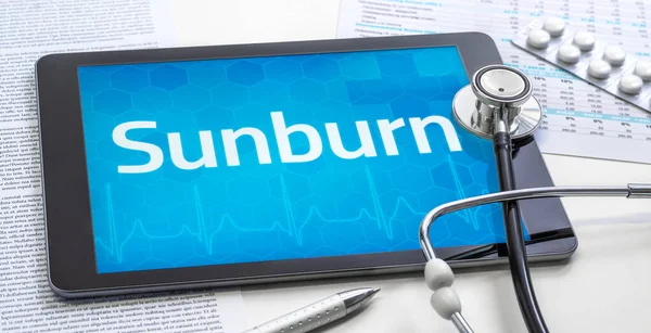 Slovo Sunburn Displeji Tabletu — Stock fotografie