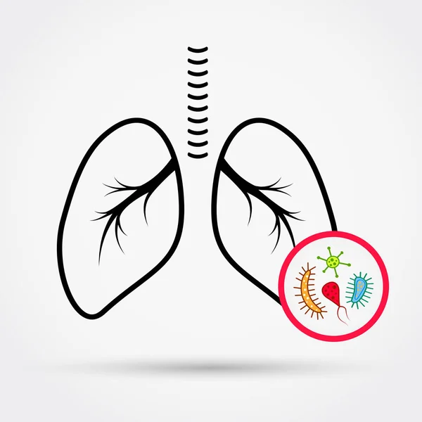 Micróbios nos pulmões. Ilustração vetorial . —  Vetores de Stock
