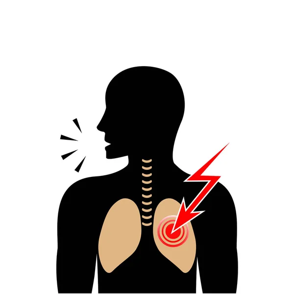 Silueta de hombre tosiendo. Dolor en los pulmones. Ilustración vectorial . — Vector de stock