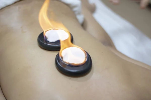 Closeup Burning Special Stones Young Woman Getting Hot Thai Massage — Stock Photo, Image