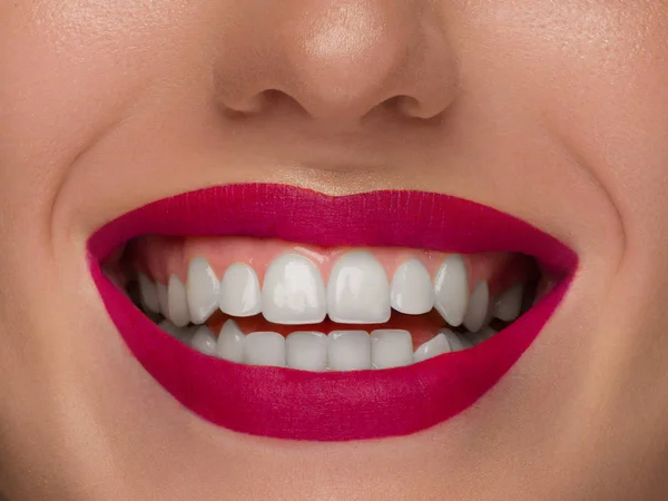 Retrato de cerca de la parte inferior de la cara de una hermosa mujer con una sonrisa blanca como la nieve. Cuidado del tacto y la piel. Lápiz labial rojo escarlata en los labios. Sonrisa blanca con dientes blancos, odontología —  Fotos de Stock