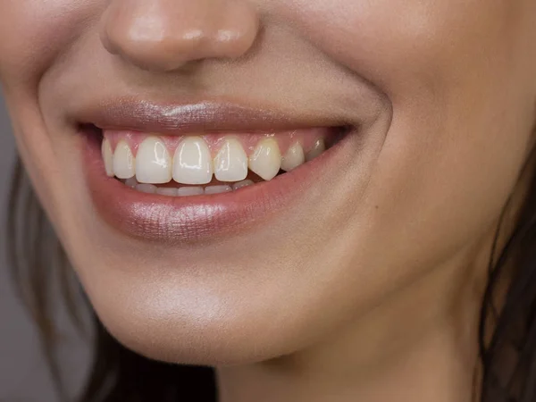 Retrato de cerca de la sonrisa de una mujer blanca como la nieve para la odontología. Hermosos labios llenos sexy con brillo labial natural. dientes lisos y piel oscura limpia —  Fotos de Stock