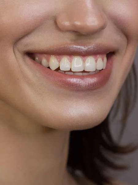 Portrait en gros plan du sourire d'une femme blanche comme neige pour la dentisterie. Belles lèvres pleines sexy avec gloss lèvres naturelles. dents lisses et peau claire et foncée — Photo