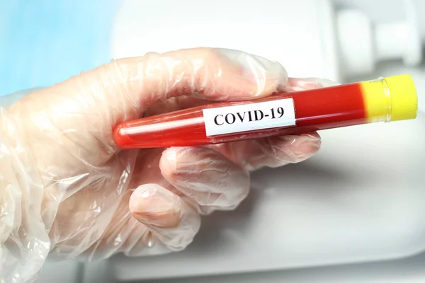 Coronavirus 2019 Itens Higiênicos Teste Tubo Mas — Fotografia de Stock