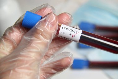 COVID-19 ve elinde kan testi olan bir doktor.
