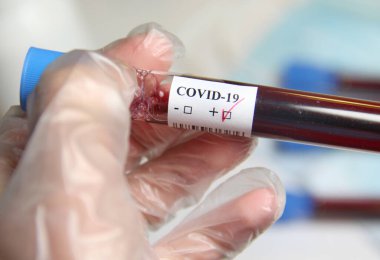 COVID-19 ve elinde kan testi olan bir doktor.