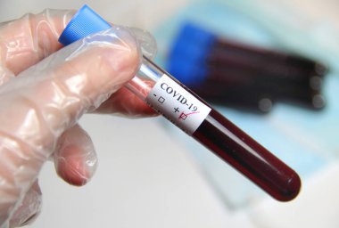 COVID-19 ve elinde kan testi olan bir doktor.