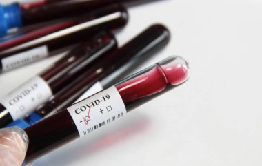 Beyaz zemin üzerinde kan testi yapılan COVID-19 tüpleri