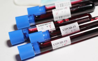 Beyaz sırtüstü kan testi yapılan COVID-19 tüpleri