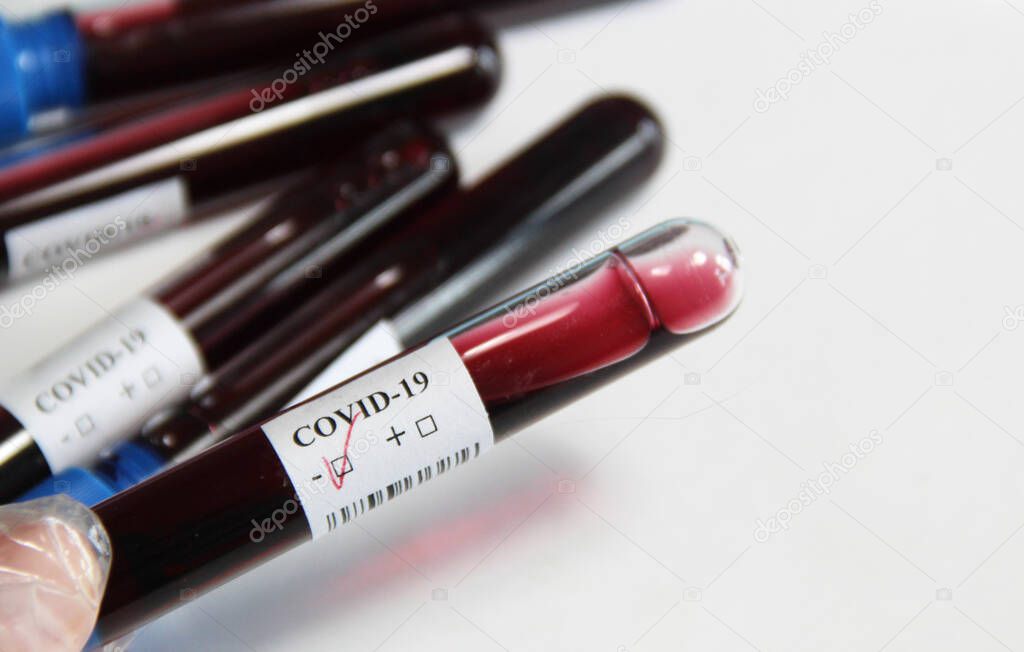 COVID-19  tubes with blood test over white background