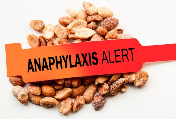 Anafilaxia Alerta Amendoins — Fotografia de Stock