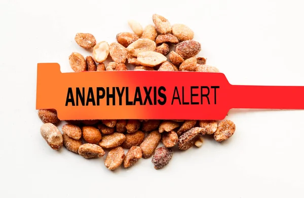 Anaphylaxie-Alarm wegen Erdnüssen — Stockfoto