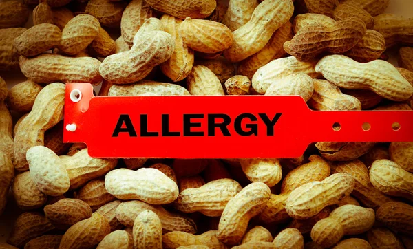 Vejce alergií na arašídy náramek — Stock fotografie