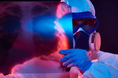 COVID-19 veya 2019-NCoV. Koruyucu PPE kıyafetli bir doktorun portresi Coronavirus zatürresi olan bir hastanın akciğerlerinin röntgenini gösteriyor.. 
