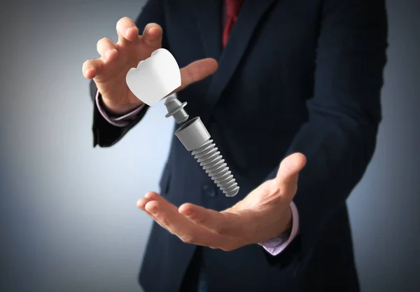 Hands Businessman Holding Dental Prosthesis Rendering — Stock Photo, Image