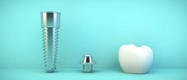 Prótesis Dental Sobre Fondo Azul Renderizado — Foto de Stock