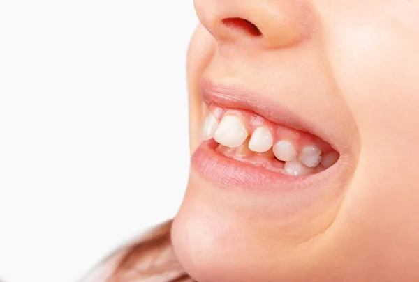 Kalıcı dişleri olan çocuk ağzı.