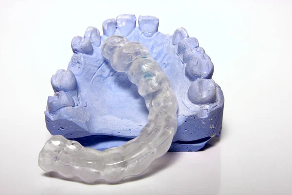 Wax Model Ceramic Dental Bridge White Background — Stock Photo, Image