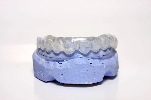 Wosk Się Model Ceramiczne Dentystycznych Most Białym Tle — Zdjęcie stockowe