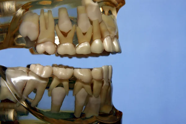 牙齿塑料模型的特写照片 — 图库照片