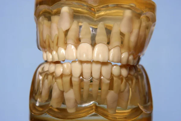 Foto Cerca Del Modelo Plástico Dental Con Dientes —  Fotos de Stock