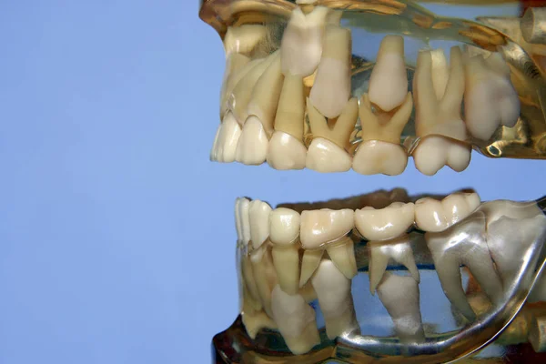 Szczegół Zdjęcia Stomatologiczne Plastikowy Model Zębami — Zdjęcie stockowe