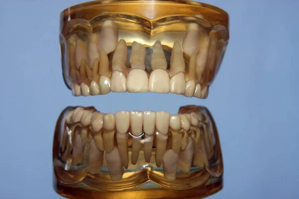 Close Photo Dental Plastic Model Teeth — Stock Photo, Image