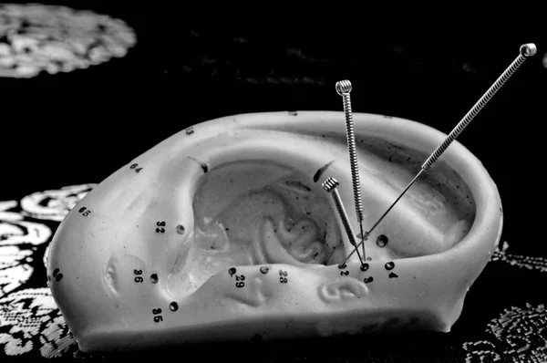 Иглы Иглоукалывания Ушной Моделью — стоковое фото